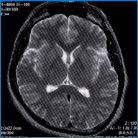 MRI検査画像例